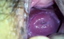 my japanese girlfend's cute cervix in huge hole